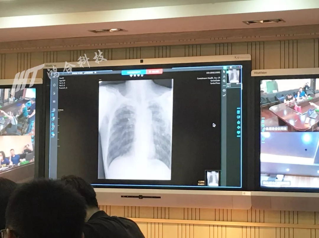结核病医院经常利用鸿合会议平板进行重要的专家会诊